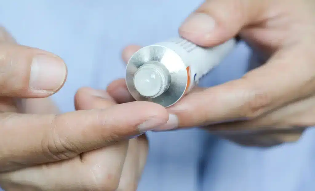 Steroid Cream for Hair Growth