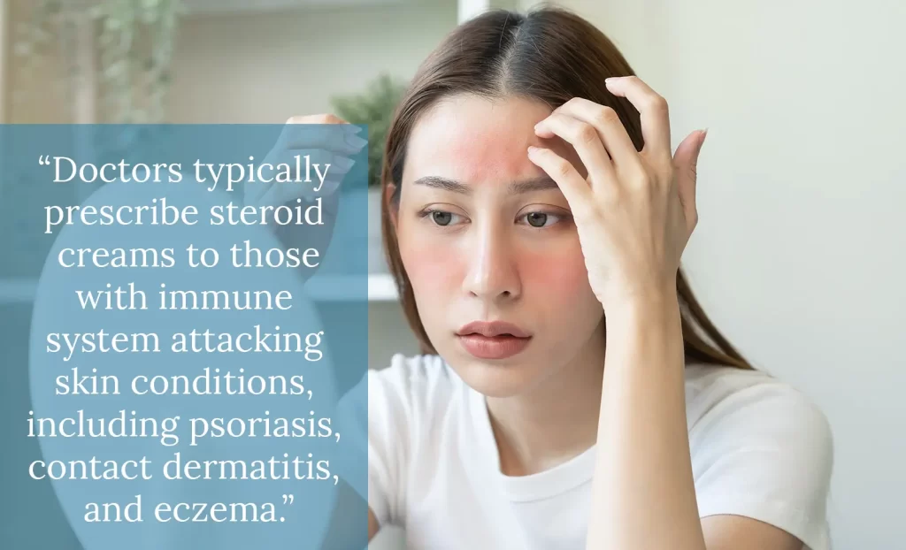 Steroid Cream for skin conditions 