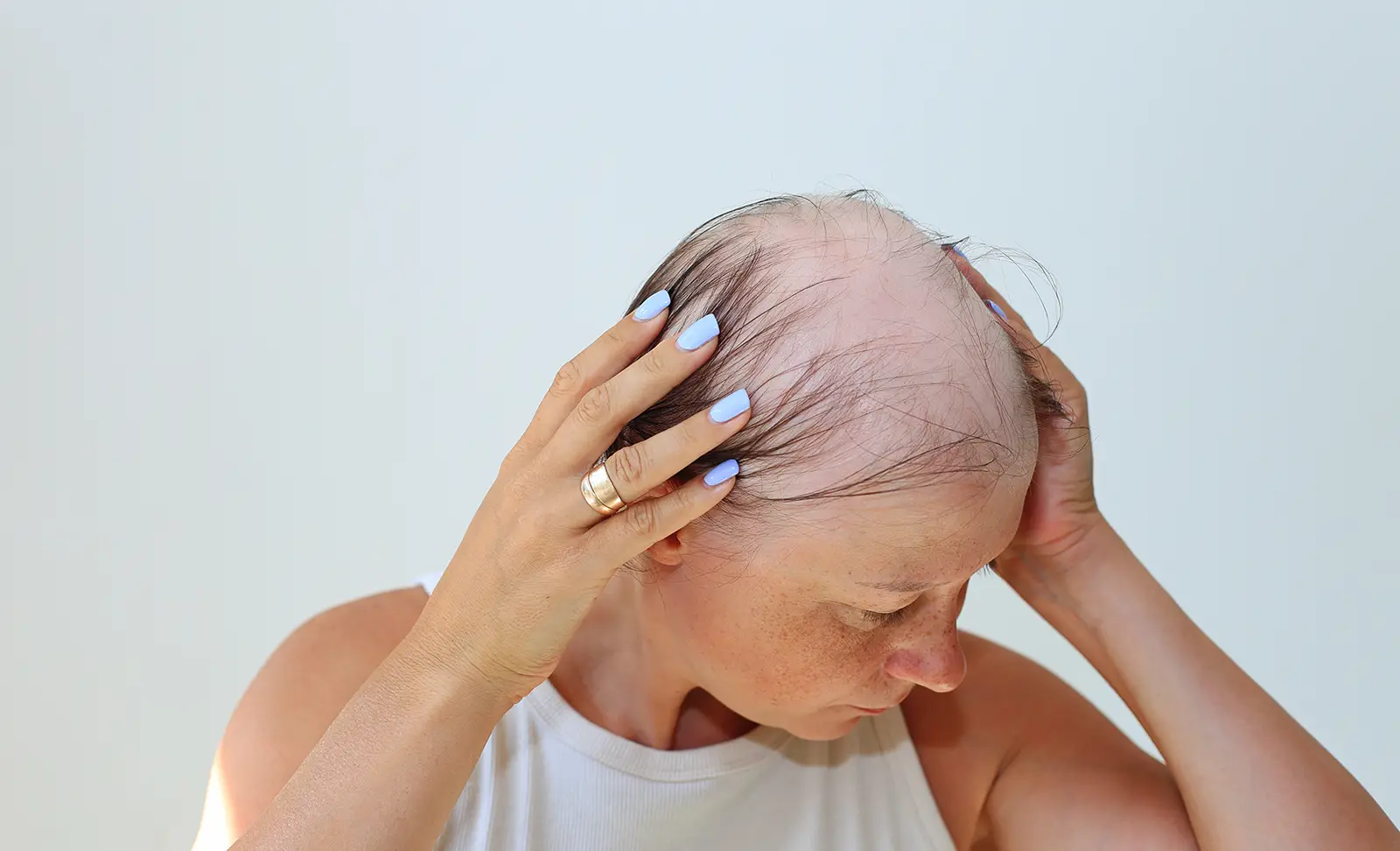Litfulo and Alopecia Treatment