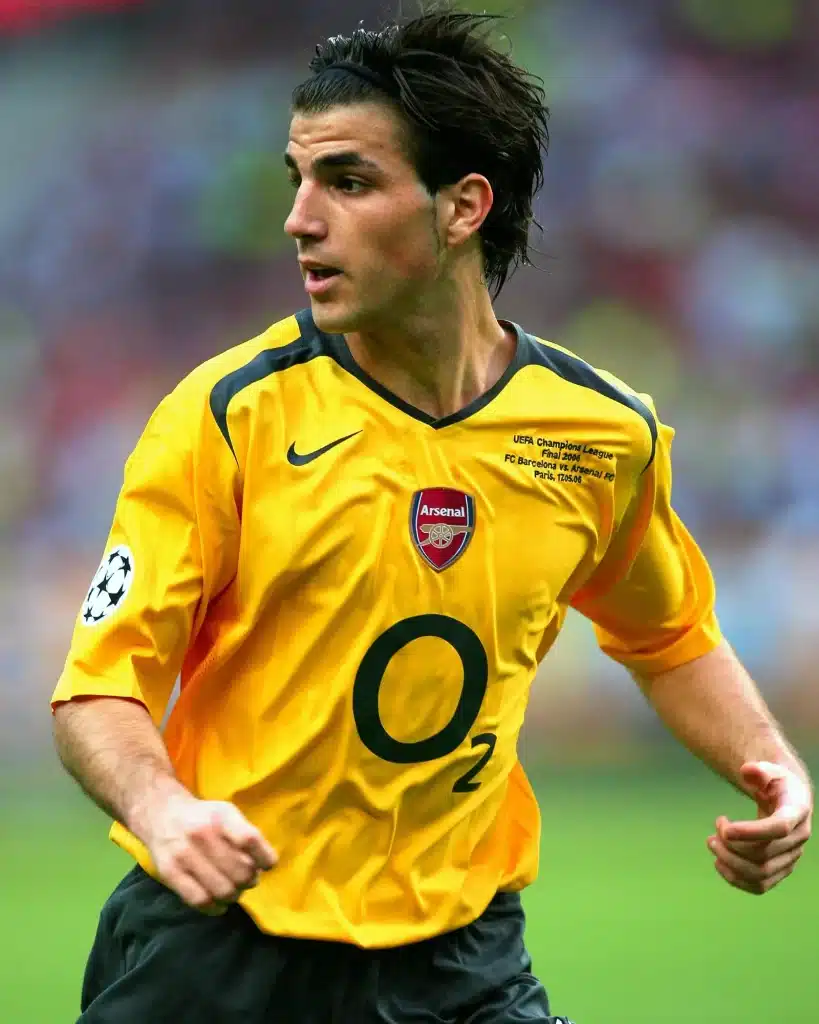 Cesc Fabregas hair transplant 2006