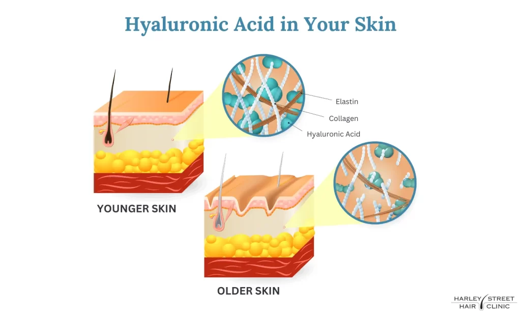  hyaluronic acid in skin