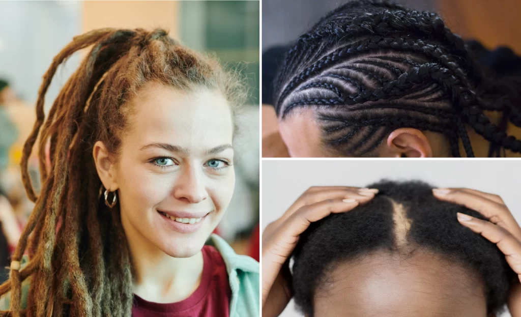 Traction alopecia and hair loss 