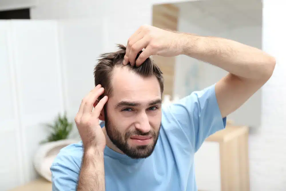Hair Density