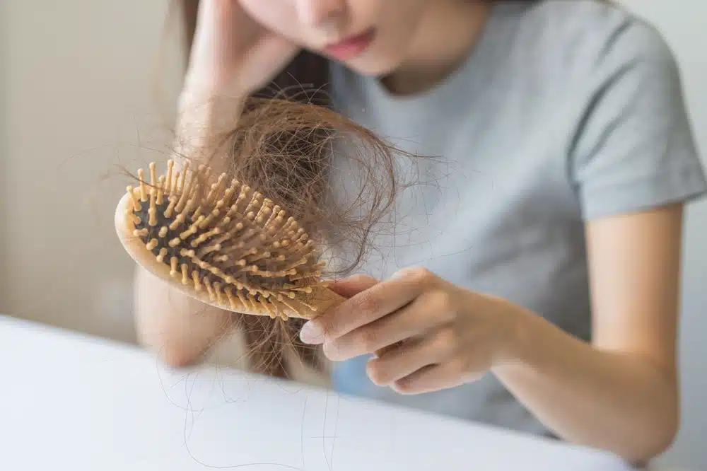 Hair loss female 