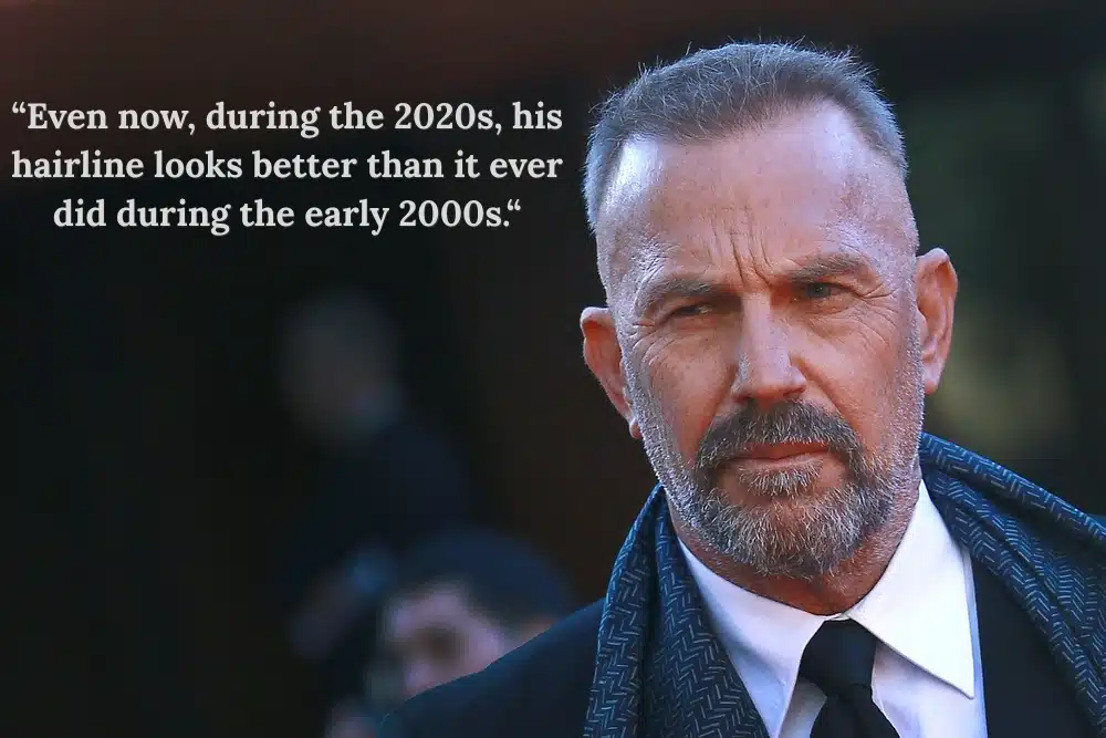 Kevin Costner  post Hair Transplant
