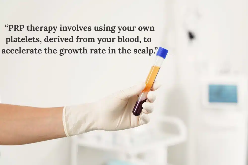 PRP therapy for hair loss 