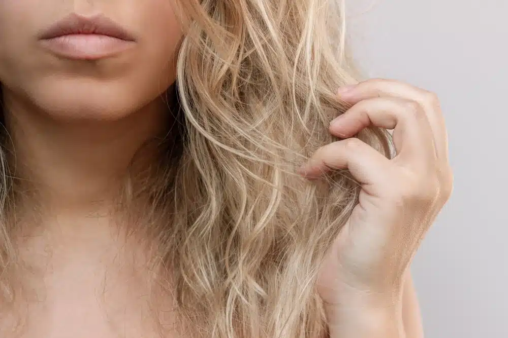 Bleach-Damaged Hair