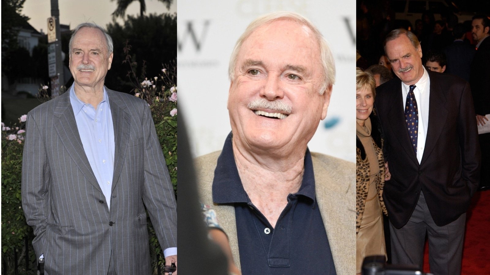 John Cleese Hair Transplant