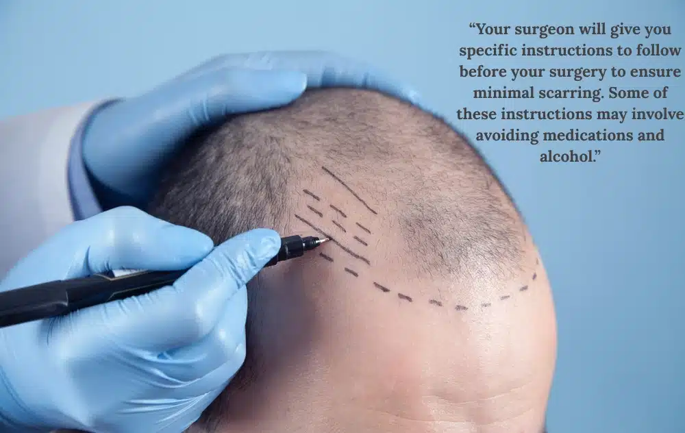 FUE Hair Transplant Scars tips