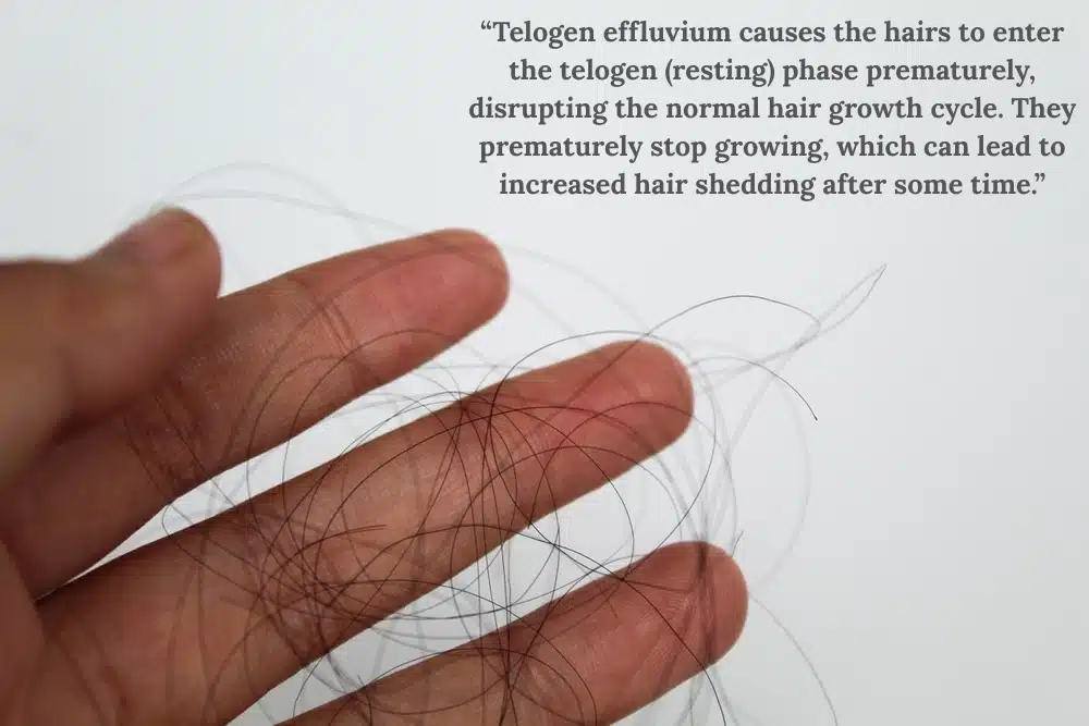 Hair shedding 
