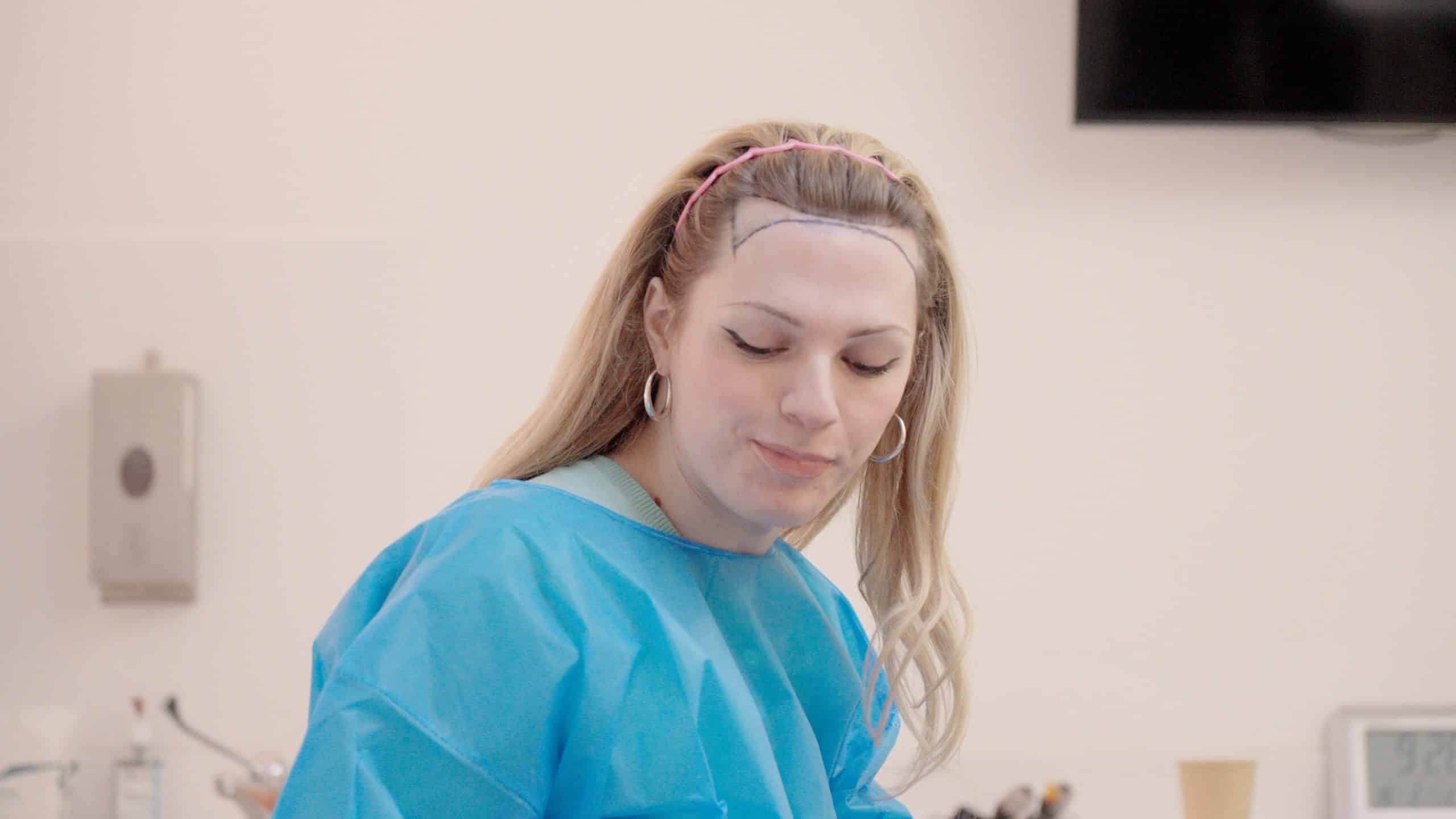 Before hair transplant Dakota