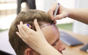 During hair tretman