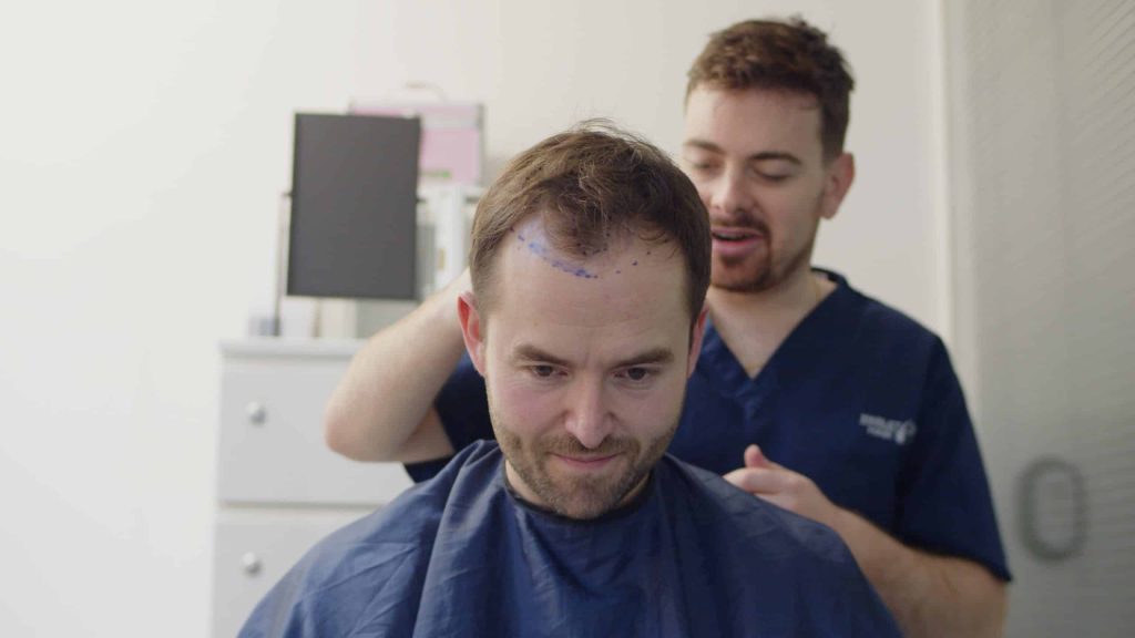 Hair Transplantation in progress