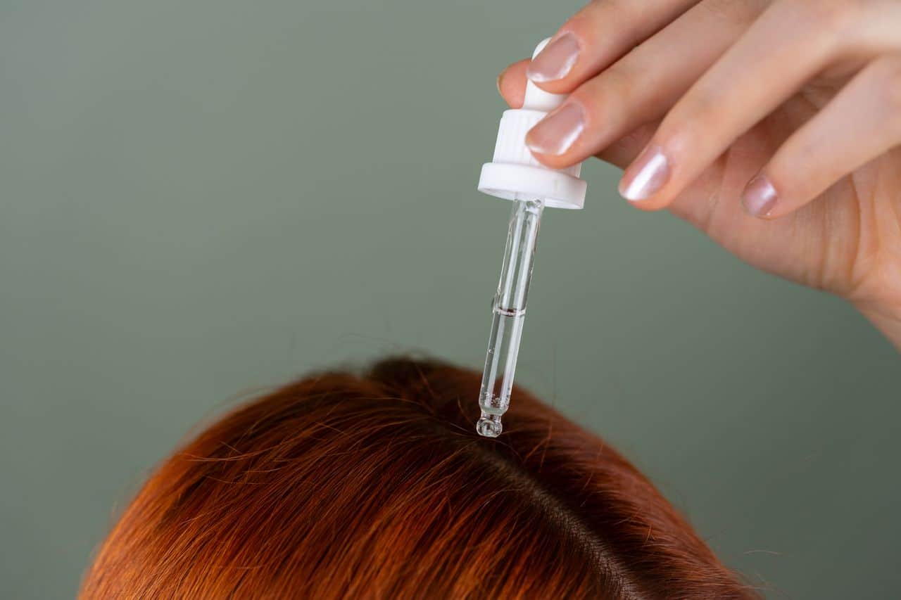Using Minoxidil